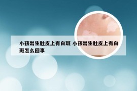 小孩出生肚皮上有白斑 小孩出生肚皮上有白斑怎么回事