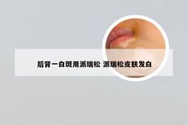 后背一白斑用派瑞松 派瑞松皮肤发白