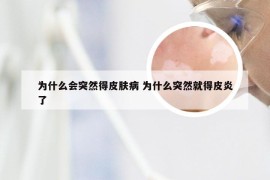 为什么会突然得皮肤病 为什么突然就得皮炎了