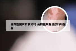 吕四医院有皮肤科吗 吕四医院有皮肤科吗医生