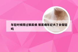 年轻时候得过银屑病 银屑病年纪大了会变轻吗