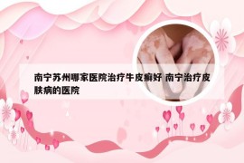 南宁苏州哪家医院治疗牛皮癣好 南宁治疗皮肤病的医院