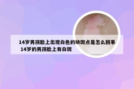 14岁男孩脸上出现白色的块斑点是怎么回事 14岁的男孩脸上有白斑