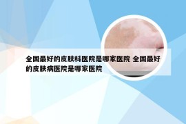 全国最好的皮肤科医院是哪家医院 全国最好的皮肤病医院是哪家医院