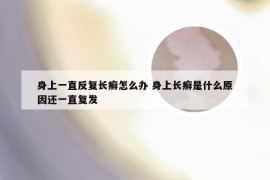 身上一直反复长癣怎么办 身上长癣是什么原因还一直复发