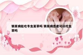 银屑病能吃冬虫夏草吗 银屑病患者可以吃虫草吗