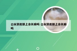 口水到皮肤上会长癣吗 口水到皮肤上会长癣吗