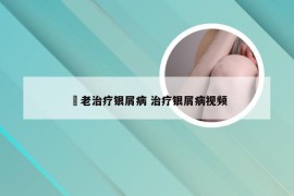 禤老治疗银屑病 治疗银屑病视频