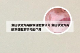 金纽尔复方丙酸氯倍他索软膏 金纽尔复方丙酸氯倍他索软膏副作用