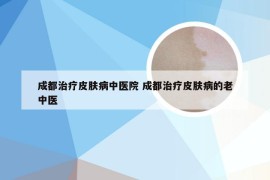 成都治疗皮肤病中医院 成都治疗皮肤病的老中医