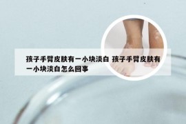 孩子手臂皮肤有一小块淡白 孩子手臂皮肤有一小块淡白怎么回事