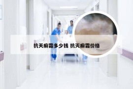 抗天癣霜多少钱 抗灭癣霜价格