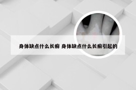 身体缺点什么长癣 身体缺点什么长癣引起的