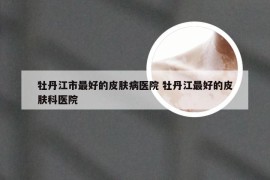 牡丹江市最好的皮肤病医院 牡丹江最好的皮肤科医院