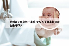 梦到儿子身上长牛皮癣 梦见儿子身上长疮背全是好吓人
