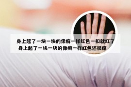 身上起了一块一块的像癣一样红色一扣就红了 身上起了一块一块的像癣一样红色还很痒