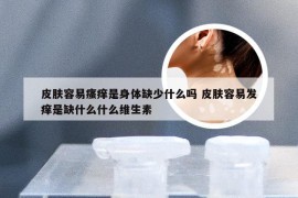 皮肤容易瘙痒是身体缺少什么吗 皮肤容易发痒是缺什么什么维生素