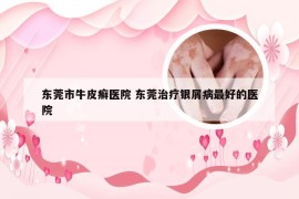 东莞市牛皮癣医院 东莞治疗银屑病最好的医院