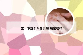 查一下这个叫什么癣 癣是啥样