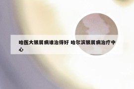哈医大银屑病谁治得好 哈尔滨银屑病治疗中心