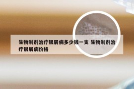 生物制剂治疗银屑病多少钱一支 生物制剂治疗银屑病价格