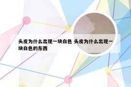 头皮为什么出现一块白色 头皮为什么出现一块白色的东西