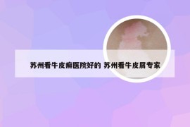 苏州看牛皮癣医院好的 苏州看牛皮屑专家