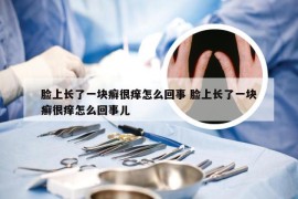 脸上长了一块癣很痒怎么回事 脸上长了一块癣很痒怎么回事儿