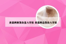 鼻梁两侧发白呈八字形 鼻梁两边发白八字形