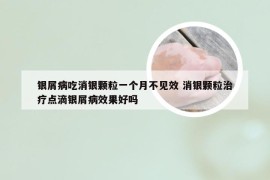 银屑病吃消银颗粒一个月不见效 消银颗粒治疗点滴银屑病效果好吗