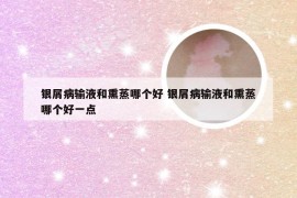 银屑病输液和熏蒸哪个好 银屑病输液和熏蒸哪个好一点