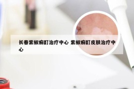 长春紫椒癣酊治疗中心 紫椒癣酊皮肤治疗中心