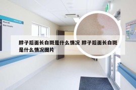 脖子后面长白斑是什么情况 脖子后面长白斑是什么情况图片