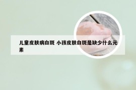 儿童皮肤病白斑 小孩皮肤白斑是缺少什么元素