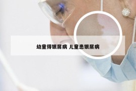 幼童得银屑病 儿童患银屑病