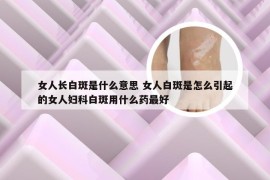 女人长白斑是什么意思 女人白斑是怎么引起的女人妇科白斑用什么药最好