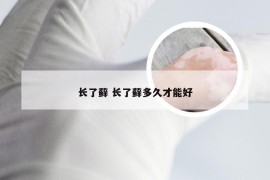 长了藓 长了藓多久才能好