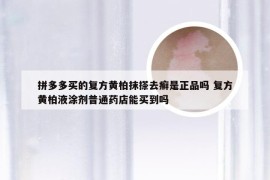 拼多多买的复方黄柏抹搽去癣是正品吗 复方黄柏液涂剂普通药店能买到吗