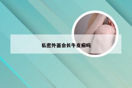 私密外面会长牛皮癣吗