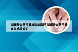 湖州什么医院看皮肤病最好 湖州什么医院看皮肤病最好的