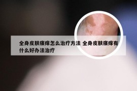 全身皮肤瘙痒怎么治疗方法 全身皮肤瘙痒有什么好办法治疗