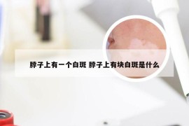 脖子上有一个白斑 脖子上有块白斑是什么
