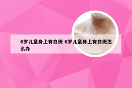 6岁儿童身上有白斑 6岁儿童身上有白斑怎么办