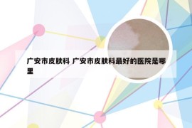 广安市皮肤科 广安市皮肤科最好的医院是哪里