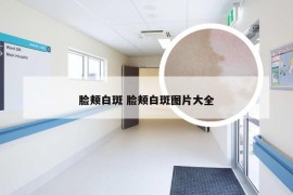 脸颊白斑 脸颊白斑图片大全