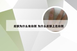 皮肤为什么有白斑 为什么皮肤上出白斑