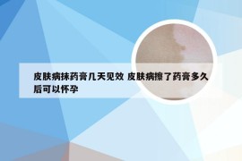 皮肤病抹药膏几天见效 皮肤病擦了药膏多久后可以怀孕