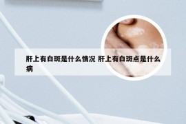 肝上有白斑是什么情况 肝上有白斑点是什么病