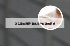怎么治白斑好 怎么治疗白斑效果好