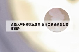 食指关节长癣怎么回事 食指关节长癣怎么回事图片